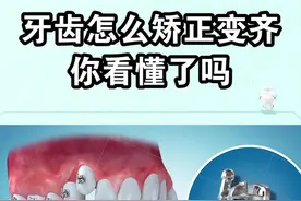 歪牙是怎么通过矫正变齐的，这个过程你看懂了吗？#dou出新知 #郑州