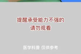 小腿截肢3D动画演示#健康 #身体健康才是赢家 #医学科普 @抖音短视频 视频封面