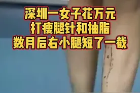女子花万元打瘦腿针和抽脂，数月后右小腿短了一截，走路一瘸一拐😰视频封面