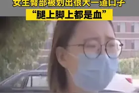 近日，新乡一女生景区上厕所突遭马桶炸裂，其屁股被严重划伤…事后景区致歉并赶紧检查了景区所有的马桶视频封面