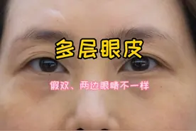 多层眼皮，眼睛两边不一样假双的眼妆调整方法#化妆教程