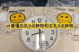 教你看懂右乳9点肿物和左乳9点肿物的位置#因数健康