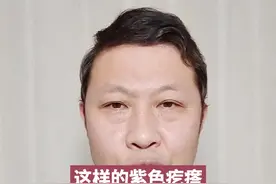 孩子屁屁旁边的紫色疙瘩是什么#育儿 视频封面