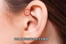耳朵的痣好或不好看了就知道#痣的含义 #同款痣 #科普视频封面