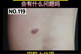 身上出现凸起的小疙瘩，硬硬的，会有什么问题吗#科普 #皮肤 视频封面