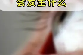 如果不小心把502胶水滴入眼睛，会是怎样的后果？告诉你急救方法#知识创作人 #科普 @DOU+小助手视频封面