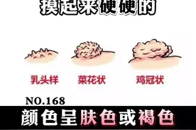 私密处长了菜花状的小丘疹，有可能是 #尖锐湿疣 ，要尽早治疗，防止扩散！#医学科普 #皮肤 #健康 #HPV  视频封面