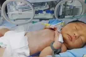 33周早产宝宝的成长经历，也是38岁二胎妈妈的”血泪”史视频封面