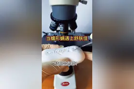 当脸上的蠕形螨遇上舒肤佳，结局会怎样？#显微镜 #内容过于真实 #除螨