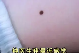 #痣 周围发痒是什么回事？视频封面