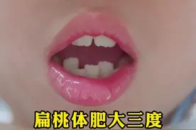 #扁桃体肥大三度，长期#张嘴呼吸#打呼噜，也出现了面容的变化！#医学科普 #耳鼻喉臧洪瑞 视频封面