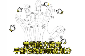 手部伤残级别的划分#工伤赔偿 #劳动能力鉴定标准 #劳动能力鉴定视频封面