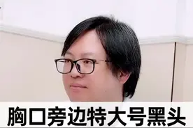 你身上有长过这种特大号的黑头吗？#皮脂腺囊肿 #黑头 #皮肤视频封面