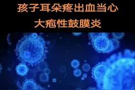 儿童感冒发烧之后出现耳朵疼,出血，小心大疱性鼓膜炎#科普一下 #大疱性鼓膜炎  #耳鼻喉急诊 #创作者计划视频封面