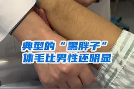 在女性胖友的体毛比男士明显 #视频仅供参考如有不适请线下就医 #减肥 #减重手术 #肥胖 #黑棘皮