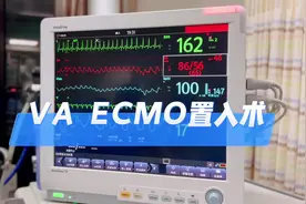 #icu #ecmo #抢救  VA-ECMO操作过程
