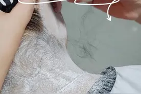 #面部清洁 #毛囊堵塞怎么疏通毛孔 #清洁毛孔的妙招 ，摆脱多余毛发，展现自信魅力。视频封面