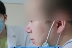 鼻子又红又肿，很可能是#酒糟鼻 #玫瑰痤疮视频封面