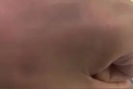 用银手镯刮手会变黑?女子给朋友狂刮不黑，自己一刮就黑。#社会百态 #手镯 #奇闻奇事视频封面