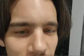 我们需要有更多飞吻的形式视频封面