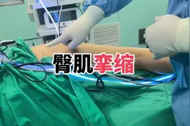 臀肌挛缩，大部分是小时候打针打多了。#医学科普 #手术室日常视频封面