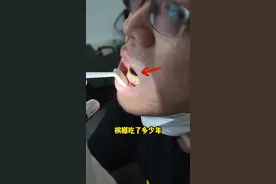 吃了太久槟榔，割嘴巴。 #陈善闻 #口腔