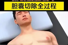 微创腹腔镜下胆囊切除全过程 #生活常识 #胆囊结石 #胆囊切除 #胆囊癌 #肿瘤医生江一博 安康市人民医院肿瘤科&安康市看肿瘤&安康市医院视频封面