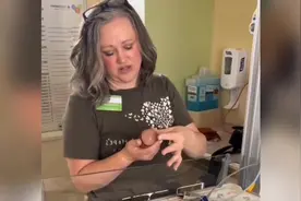 这么小的早产宝宝，真的假的？ 巴掌大小早产儿