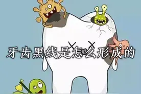牙齿上的黑线是怎么样形成的#牙齿 #科普 #牙粉 #好物推荐🔥