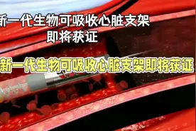 上海微创研发火鹮心脏支架：创新科技，改变生活视频封面