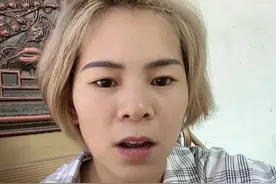 我带吸附性义齿的感受。给你们个参考 ❤️#假牙 #牙齿
