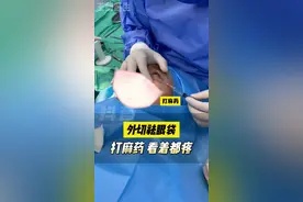 #眼袋 #眼袋手术视频封面