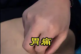 #胃痛 #胃疼 #扎针 #针灸调理 #曹方针灸工作室