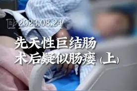 小儿外科转诊患者，在外院行巨结肠手术后疑有肠瘘！听说院长名气也挺大的，就慕名而来了！#先天性巨结肠#儿科医生#肠镜检查#疑难杂症#医者仁心