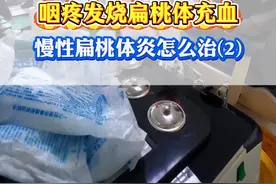 （2）反复咽疼发烧、扁桃体充血，慢性扁桃体炎该怎么治疗？#咽疼 #扁桃体炎  #扁桃体发炎 #慢性扁桃体炎 #耳鼻喉刘军视频封面