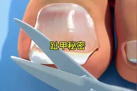 脚趾甲的正确剪法，你怎么剪的呢，趾甲的秘密#脚趾甲