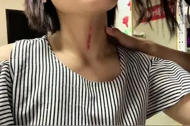 揪痧视频教程来喽#美业人的日常视频封面