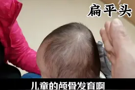 扁平头怎么睡好 #扁平头 #头型 #医疗健康创作训练营，#抖出健康知识宝藏视频封面