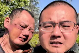 我们都是例子，长期咀嚼干槟榔会带来什么#长期嚼槟榔的危害有多大 #经历过的人才能深有体会