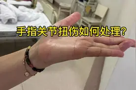 手指关节扭伤如何处理？#医学科普 #科普一下 #科普医生视频封面