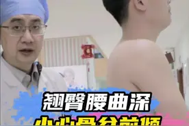 #翘臀 #翘臀美臀 #骨盆前倾 #腰曲过大骨盆前倾 #腰椎滑脱视频封面