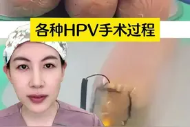 宫颈病变，到底是选激光、利普刀、冷刀锥切，哪个好？ #医学科普 #女性科普