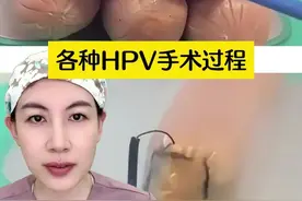 宫颈病变，到底是选激光、利普刀、冷刀锥切，哪个好？ #医学科普 #女性科普