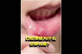 口腔溃疡为什么会那么疼？有什么办法能快速愈合？ #科普一下