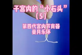 #妇科知识科普 #女性科普 #女性节育环视频封面