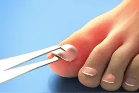 脚指甲里面的三个冷知识视频封面