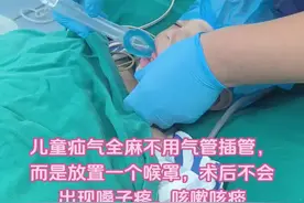很多家长以为全麻就会气管插管#疝气 #微创手术 #腹股沟疝视频封面