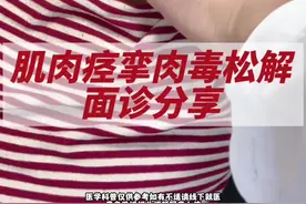 肌肉痉挛打肉毒素，案例分享！#医学科普 #肌肉痉挛 #肉毒素 #神经