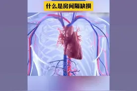 房间隔缺损 3D 动画#房间隔缺损 #房间隔缺损能治好吗 @胸外科王医生 @万峰心脏不停跳医生 @心内科王大夫视频封面