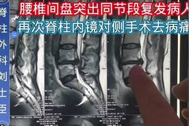 腰椎间盘突出术后复发了怎么办！！！？？？#腰椎间盘突出视频封面